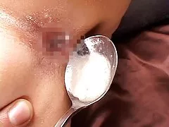 由雄激素的集合宝莲 32